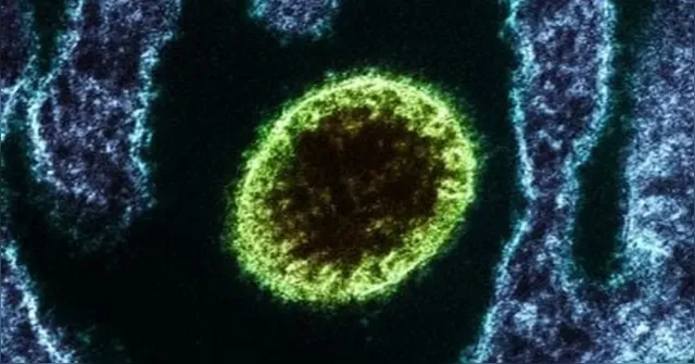 Imagem ilustrativa da notícia Vírus Nipah: veja principais sintomas, riscos e como se prevenir