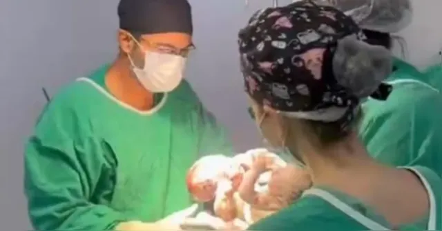 Imagem ilustrativa da notícia Cirurgia de separação termina com morte de gêmeos siameses 