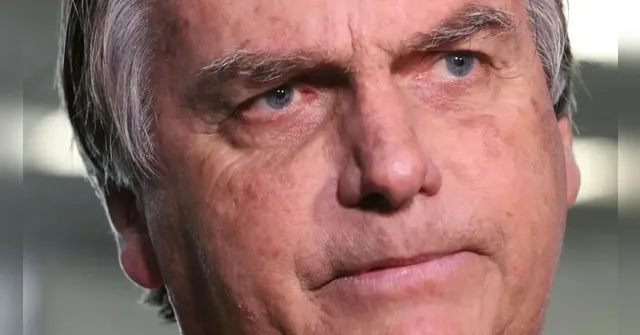 Imagem ilustrativa da notícia Bolsonaro passa por cirurgia e médicos avaliam novo procedimento