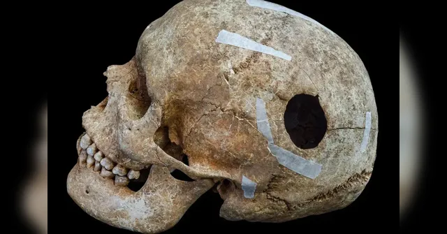 Imagem ilustrativa da notícia Descoberta macabra revela mortes horríveis de 1200 anos