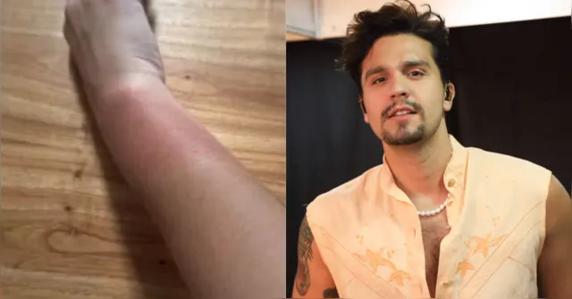 Imagem ilustrativa da notícia Fãs relatam queimaduras por pulseiras de LED em show de Luan Santana