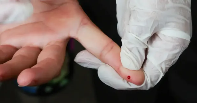 Imagem ilustrativa da notícia SUS oferece teste rápido para dengue com resultado em minutos