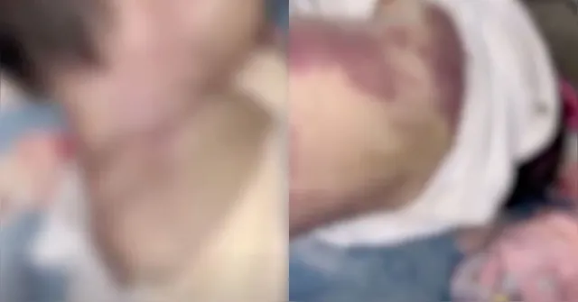 Imagem ilustrativa da notícia Criança de 2 meses é encontrada morta com diversas marcas pelo corpo