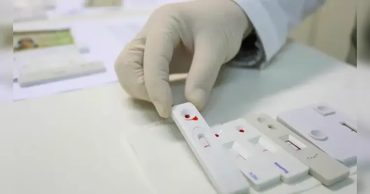 Imagem ilustrativa da notícia Belém passa a ofertar teste DNA-HPV gratuitamente; veja os locais!