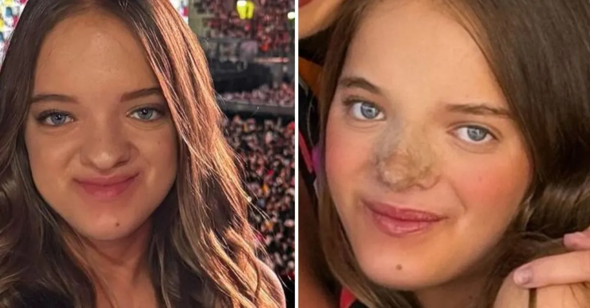 Rafaella Justus exibe resultado de nova rinoplastia e diz que mudança foi motivada por escolha pessoal e autocuidado.