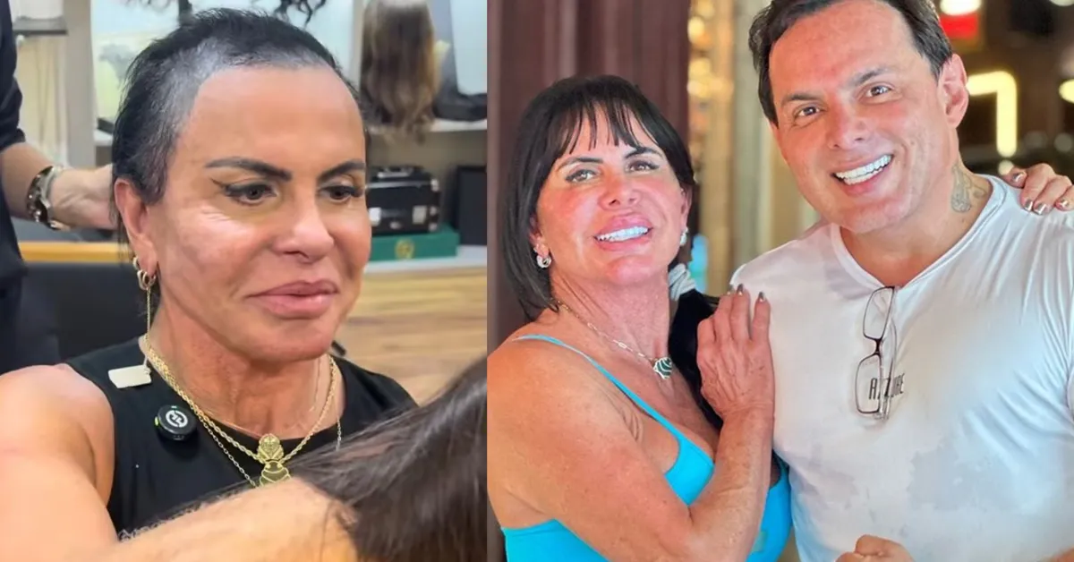 Gretchen revelou que escondia a alopecia até dentro de casa por insegurança com a aparência.