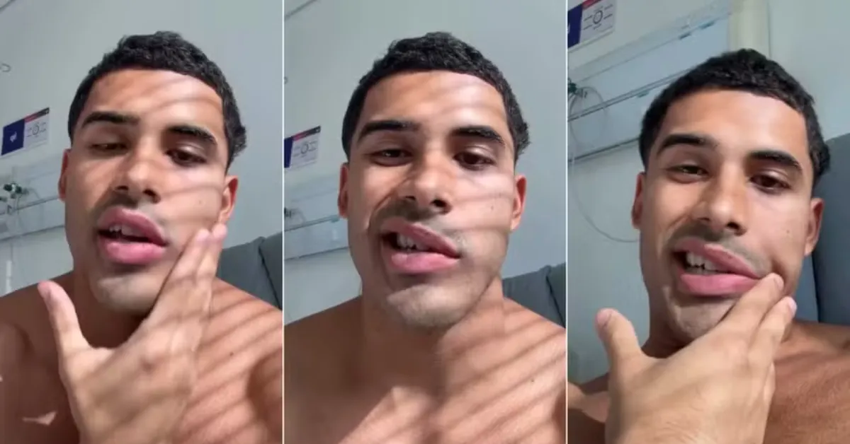 Paralisia de Bell afeta os movimentos de um dos lados do rosto e, na maioria dos casos, tem recuperação completa.
