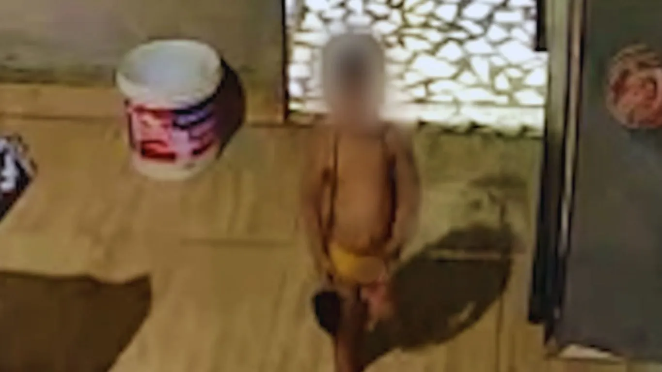 Imagens de monitoramento registraram o momento do acidente doméstico em Parauapebas; menino sofreu queimaduras graves na região do pescoço.