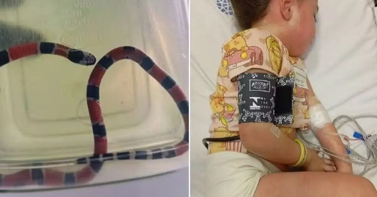 Criança ficou estado grave devido a picada da cobra