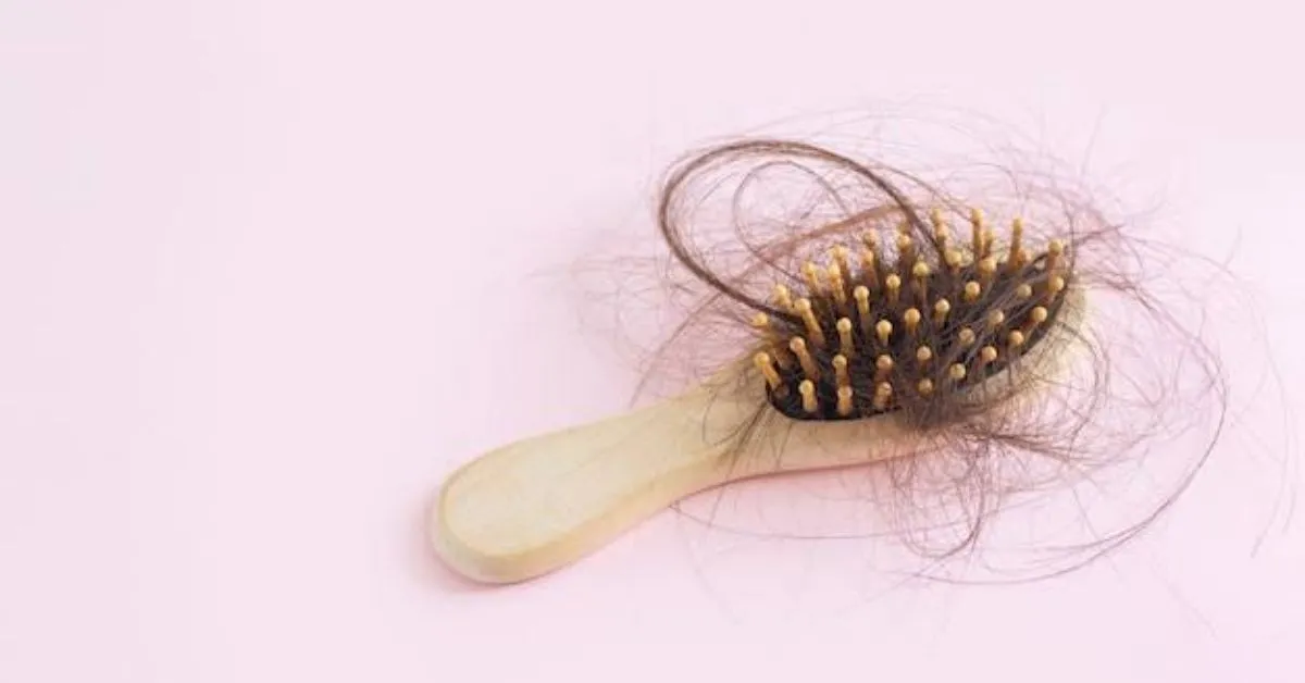 A alopecia fibrosante frontal é uma das doenças que tem ligaçãoi direta com o uso de anticoncepcionais.