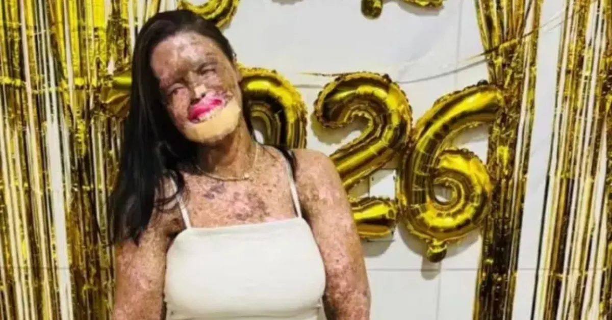 A influenciadora recebeu o diagnóstico de xeroderma pigmentoso, condição que deixa a pele extremamente sensível à luz solar. A doença provoca predisposição ao câncer de pele, conforme relatos da própria jovem sobre sua rotina de tratamentos.