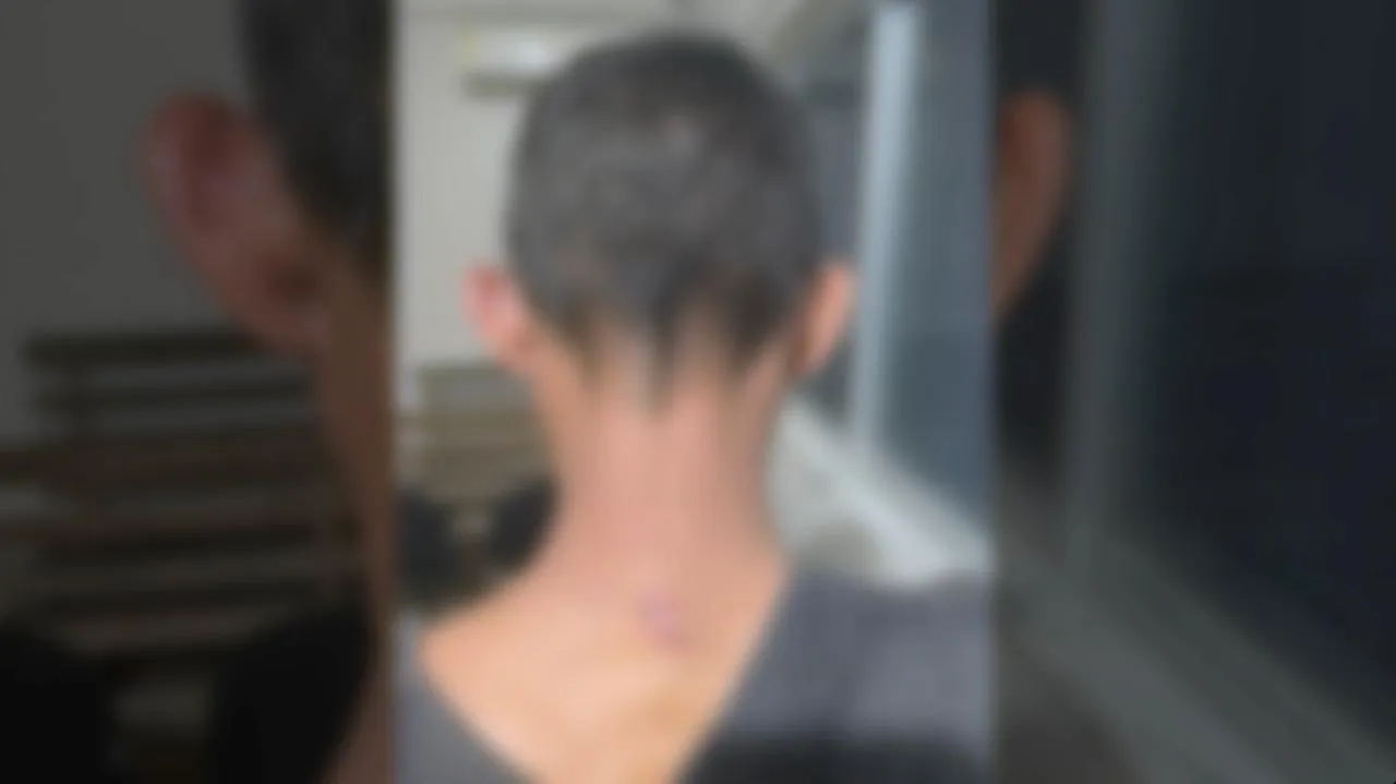 Homem sofreu ferimento na cabeça e nuca devido o golpe recebido com a pá