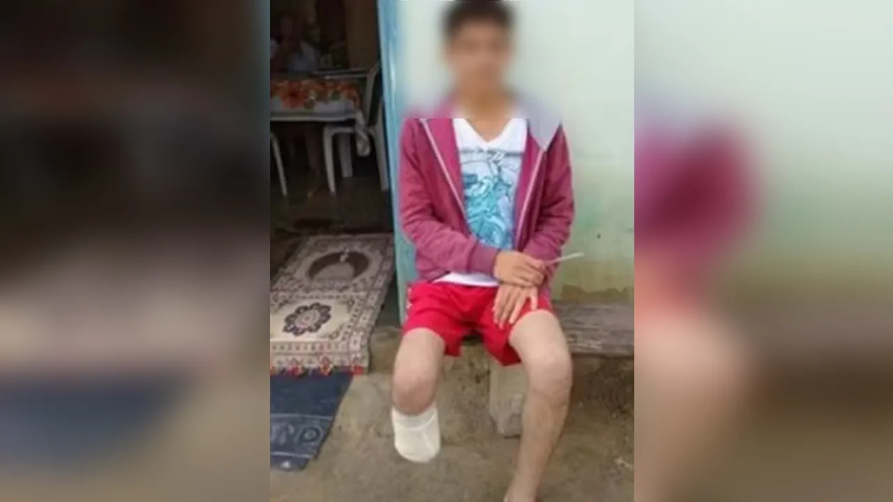 O servidor público teria amputado o próprio pé para ter direito ao valor milionário do seguro