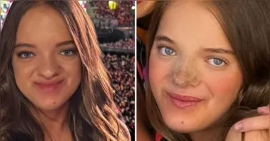 Rafaella Justus exibe resultado de nova rinoplastia e diz que mudança foi motivada por escolha pessoal e autocuidado.