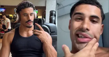 Cantor Nilo tranquilizou os fãs nas redes sociais após diagnóstico de paralisia de Bell e início do tratamento médico.