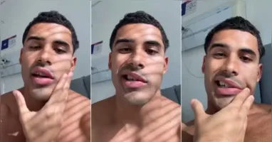 Paralisia de Bell afeta os movimentos de um dos lados do rosto e, na maioria dos casos, tem recuperação completa.