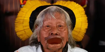 Aos 94 anos, Cacique Raoni segue em estado grave na UTI após diagnóstico de obstrução intestinal.