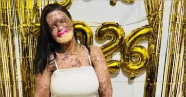 A influenciadora recebeu o diagnóstico de xeroderma pigmentoso, condição que deixa a pele extremamente sensível à luz solar. A doença provoca predisposição ao câncer de pele, conforme relatos da própria jovem sobre sua rotina de tratamentos.