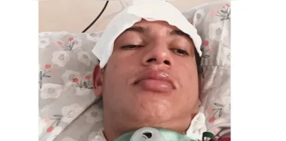 Família busca apoio para que jovem passe por procedimento especializado e possa recuperar a respiração pelo nariz.