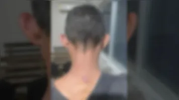 Homem sofreu ferimento na cabeça e nuca devido o golpe recebido com a pá