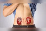 A obesidade aparece como uma nova vilã para doença renal