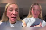O peeling escolhido pela influenciadora é um procedimento bastante conhecido no universo da estética.