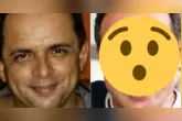 Esdras de Souza compartilhou nas redes sociais o resultado dos procedimentos estéticos realizados no rosto e recebeu elogios dos seguidores.