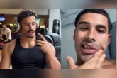 Cantor Nilo tranquilizou os fãs nas redes sociais após diagnóstico de paralisia de Bell e início do tratamento médico.