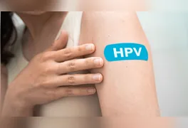 O Papilomavírus Humano (HPV) se mantém como a infecção sexualmente transmissível (IST) mais comum em todo o mundo