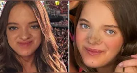 Rafaella Justus exibe resultado de nova rinoplastia e diz que mudança foi motivada por escolha pessoal e autocuidado.