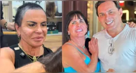 Gretchen revelou que escondia a alopecia até dentro de casa por insegurança com a aparência.