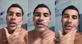Paralisia de Bell afeta os movimentos de um dos lados do rosto e, na maioria dos casos, tem recuperação completa.
