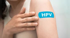 O Papilomavírus Humano (HPV) se mantém como a infecção sexualmente transmissível (IST) mais comum em todo o mundo
