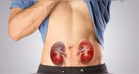 A obesidade aparece como uma nova vilã para doença renal