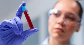 O Galleri é um teste de rastreio multicâncer, termo preferido pelos oncologistas ao invés de biópsia líquida, embora os dois signifiquem a mesma coisa.