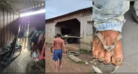 O trabalhador vivia em isolamento total há quase oito anos, sem acesso a condições mínimas de dignidade.