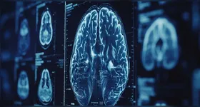 Estudo reforça que o desenvolvimento da doença não depende apenas da genética.