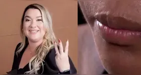 A agressora foi presa no estado do Piauí, após fugir
