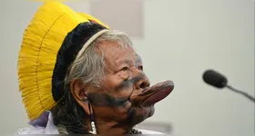 A condição pré-existente decorrente de um acidente que sofreu há mais de 20 anos.