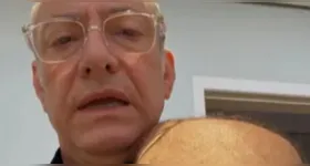 José Roberto Burnier relatou nas redes sociais ter sido atacado por um pitbull durante passeio com seus cachorros em São Paulo; apresentador mostrou ferimentos e criticou uso irregular de guia.