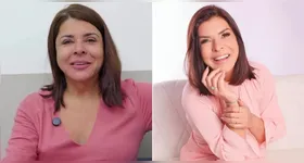 A técnica consiste em uma espécie de cirurgia plástica que diminuiu as rugas e marcas de expressão do rosto