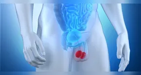 Conscientize-se sobre o câncer de testículo