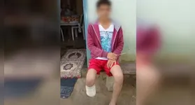 O servidor público teria amputado o próprio pé para ter direito ao valor milionário do seguro