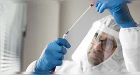 Paciente internado no Instituto Emílio Ribas teve resultado negativo para ebola; diagnóstico confirmado é de meningite meningocócica.