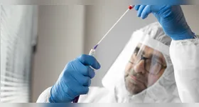 O Ebola é uma doença viral grave que provoca febre hemorrágica e apresenta alta taxa de mortalidade.