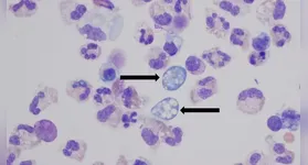 Saiba mais sobre a ameba comedora de cérebros e os riscos após morte em Rondônia. Entenda como evitar infecções e a relação com mudanças climáticas.