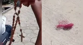 Um motociclista se salviu de um grave acidente com linha cortante devido a um terço e alerta sobre os perigos das pipas no Pará.