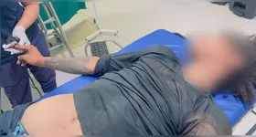 O suspeito foi preso pela polícia, pulou de viatura e recebeu atendimento médico