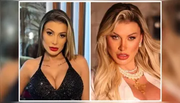 Imagem ilustrativa da imagem Andressa Urach exibe resultado de cirurgia facial de R$ 240 mil