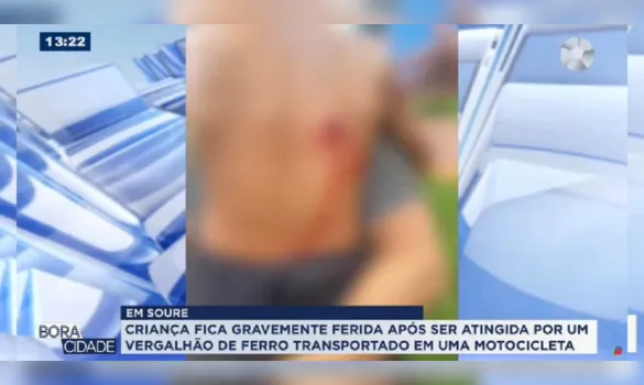 Imagem ilustrativa da imagem Criança é atingida por vergalhão transportado em moto no Marajó